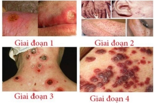 Ảnh Bệnh Xã Hội (2)