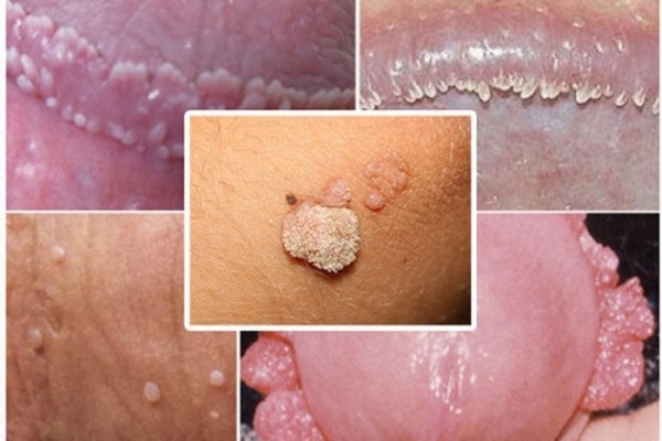 Ảnh Bệnh Xã Hội