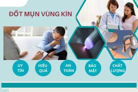 Tìm hiểu về phương pháp đốt mụn ở vùng kín