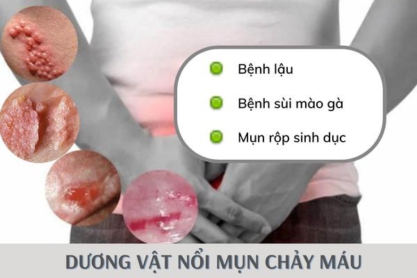 duong-vat-noi-mun-chay-mau-1