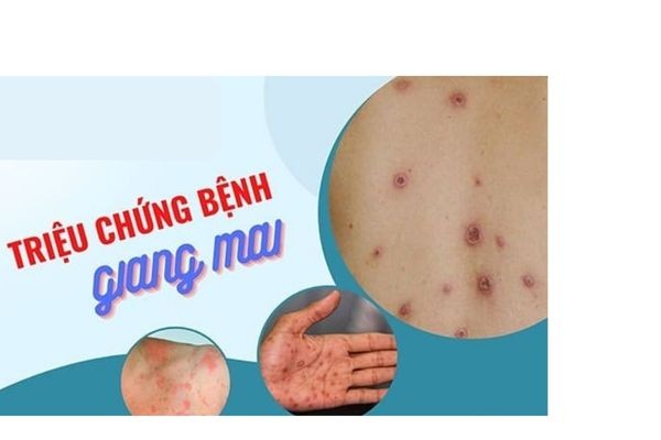 giang-mai-2