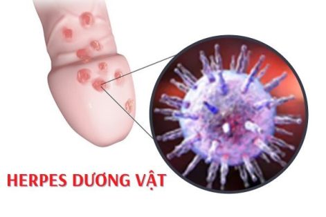 Thông tin cần biết về bệnh Herpes dương vật