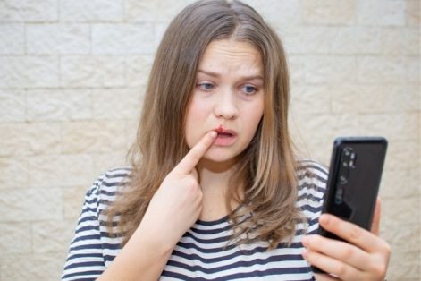 Làm thế nào để điều trị Herpes môi?