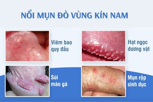 mun-do-vung-kin-nam-1