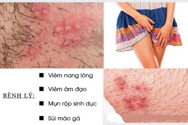 mun-do-vung-kin-nu-1