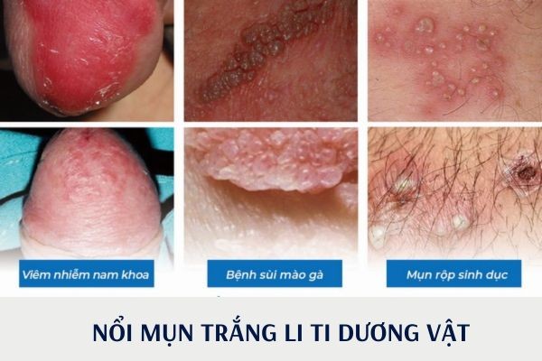 noi-mun-trang-li-ti-duong-vat-1
