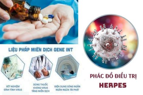 Phác đồ điều trị Herpes sinh dục hiệu quả