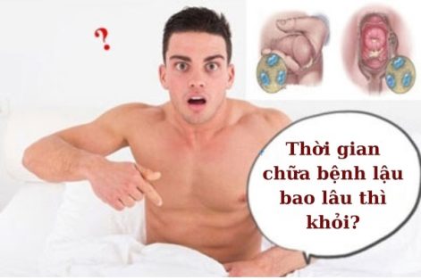 Thời gian chữa bệnh lậu bao lâu thì khỏi?
