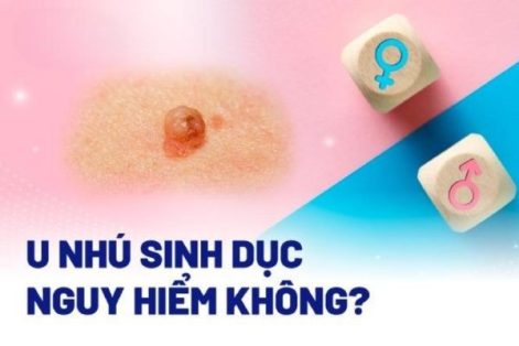 U nhú sinh dục nguy hiểm không?