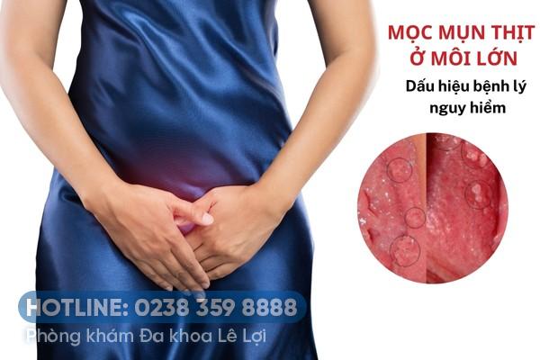 moc-mun-thit-o-moi-lon