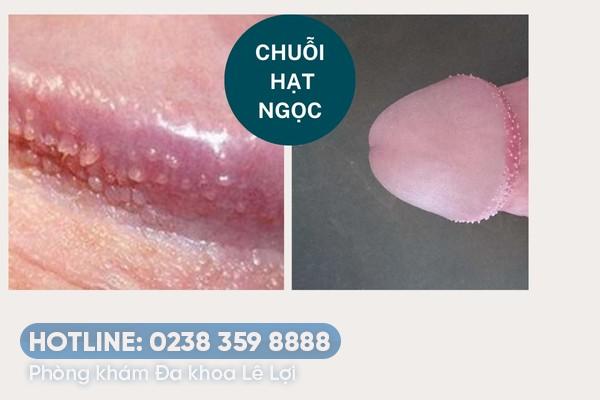 chuoi-hat-ngoc (1)