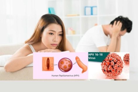 HPV có tự khỏi không và cách điều trị