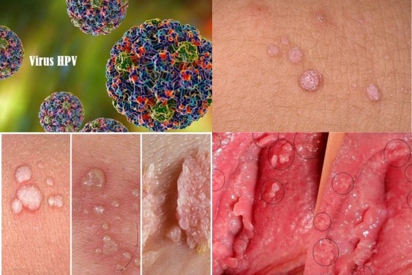 mun-sui-mao-ga-virus